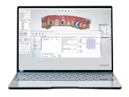 3Shape Software - Basic-Version - 14